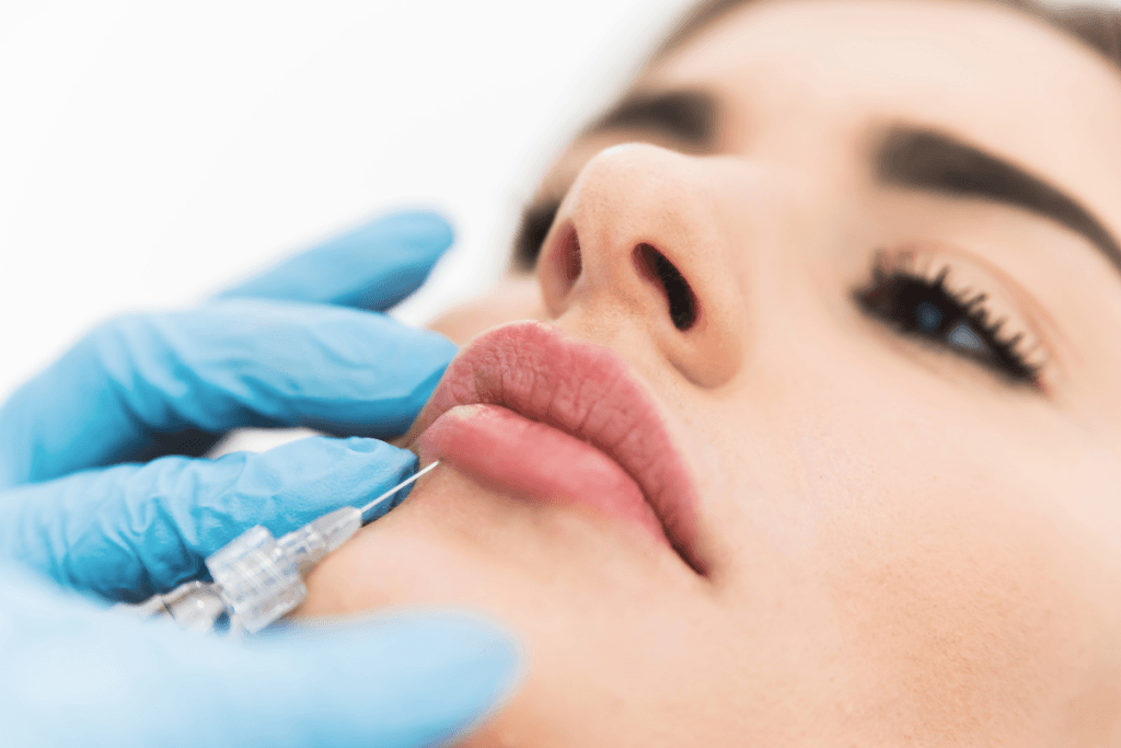 Aliaxin FL Lips Filler