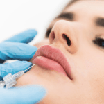 Aliaxin FL Lips Filler