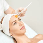 Mediderma Peel