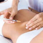 Sculptra vs Radiesse