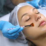 Biorepeel Chemical Peel