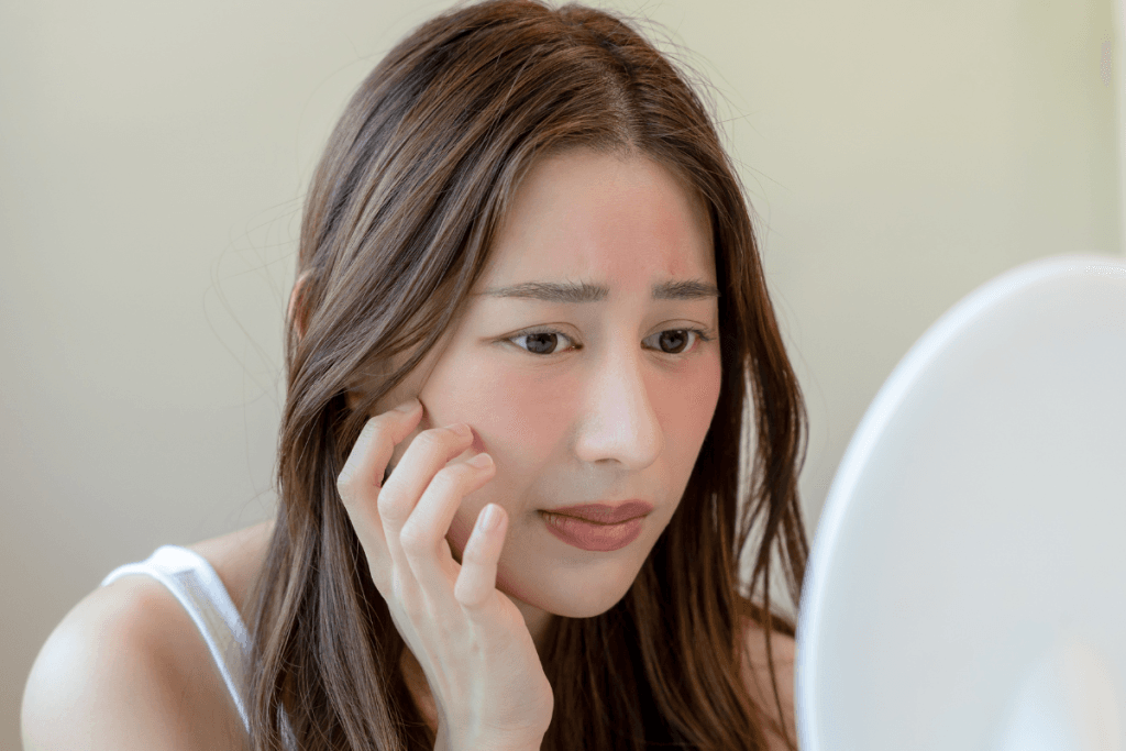 Side Effects of Juvederm