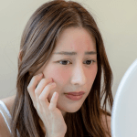 Side Effects of Juvederm